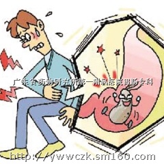 什么是结肠炎克隆病,结肠炎的症状,结肠炎的治